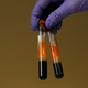 Patient samples to be tested for coronavirus antibodies.